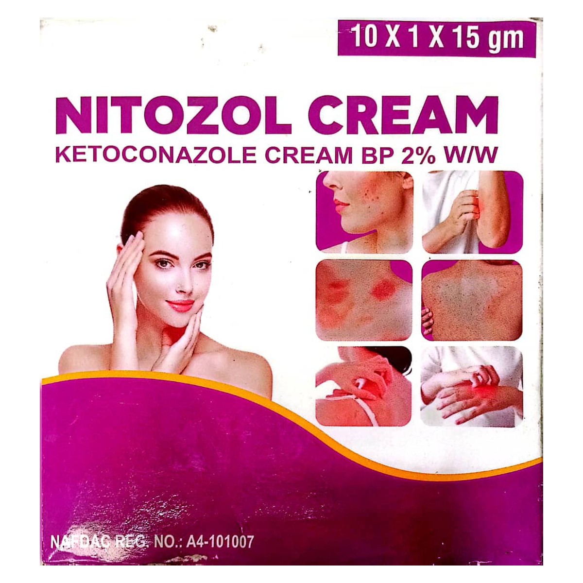 Ketoconazole Cream
